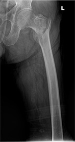 x-ray 사진