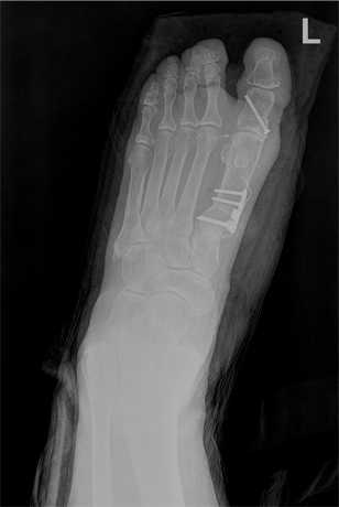 x-ray 사진
